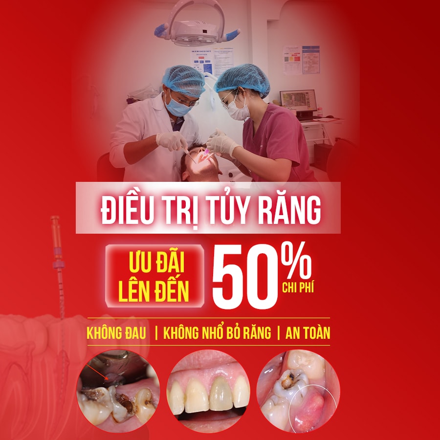 điều trị tủy răng