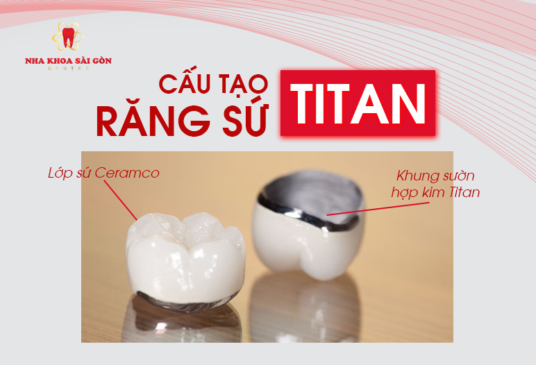 cấu tạo răng sứ titan