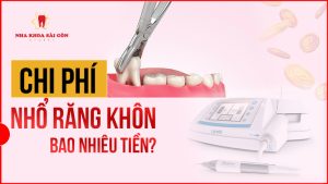 nhổ răng khôn bao nhiêu tiền