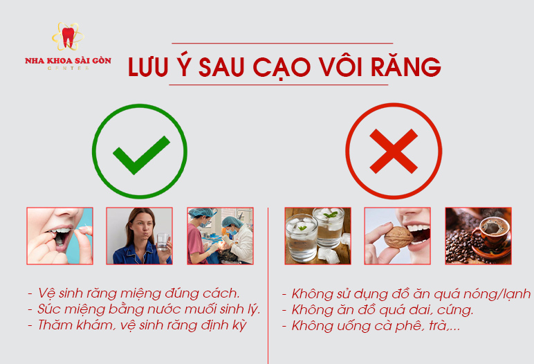 lưu ý sau khi cạo vôi răng