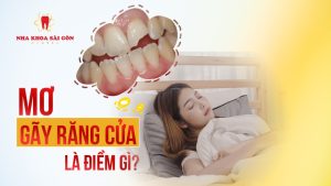 mơ thấy gãy răng cửa