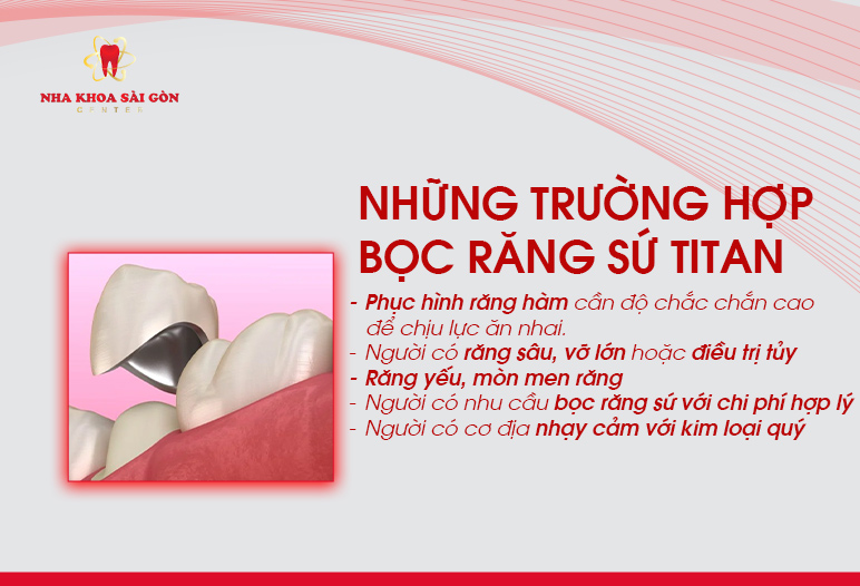 những trường hợp nào bọc răng sứ titan