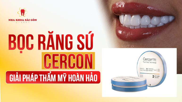 bọc răng sứ cercon