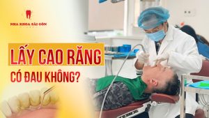 lấy cao răng có đau không
