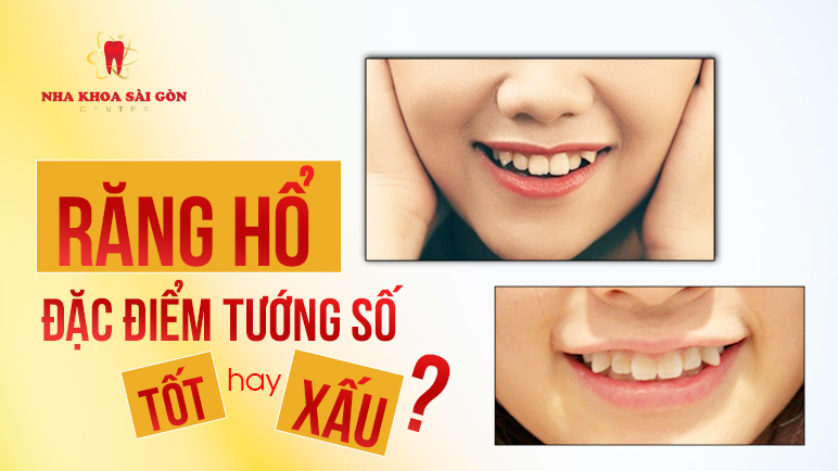 răng hổ ở người