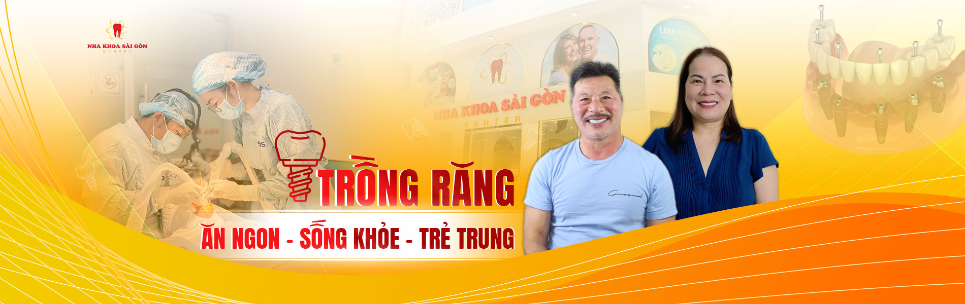 nha khoa trồng răng cho người trung niên