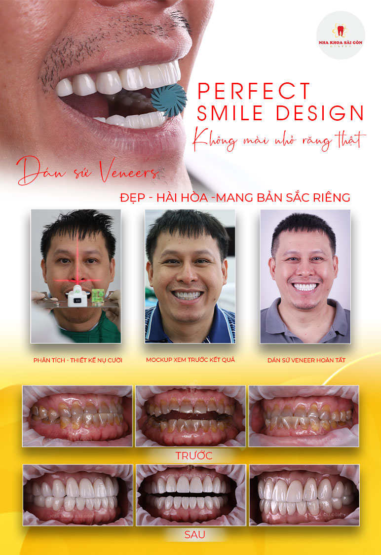 địa chỉ dán sứ đẹp